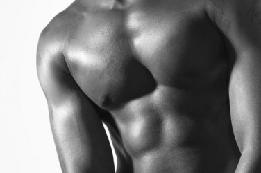 Gynecomastia
