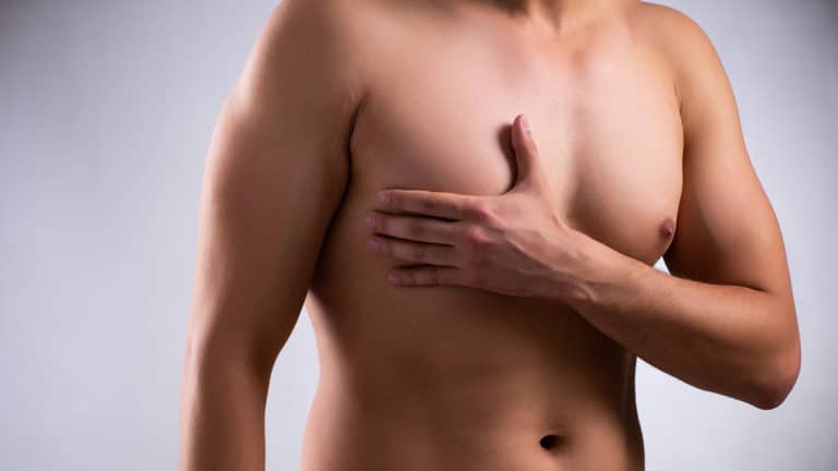 Male Breasts