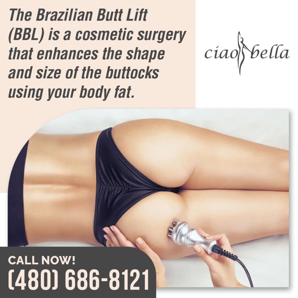 Brazilian butt lift
